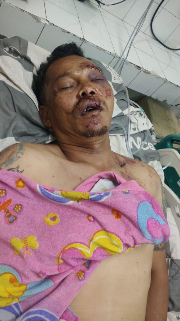 Kecelakaan di Wilayah Pacet Cibangoak, Ketua BPKB Banten PAC Majalaya dan Pimred Garda News Indonesia Alami Luka